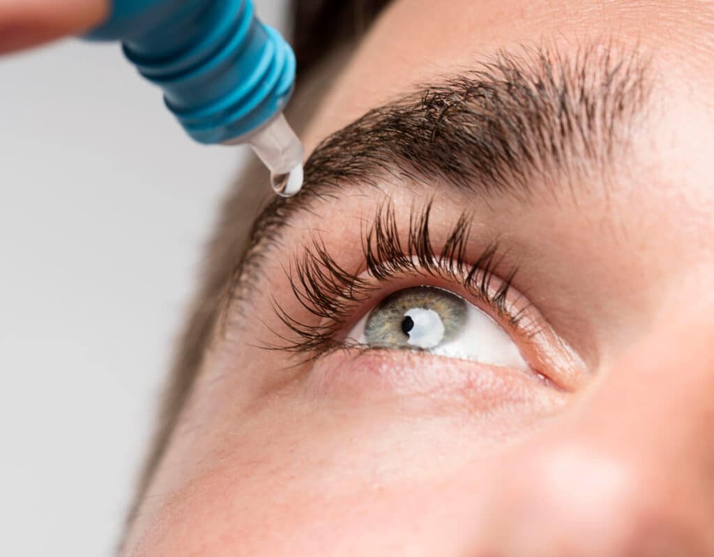 Corneal Crosslinking Post-Operative Expectations | Patient's Guide